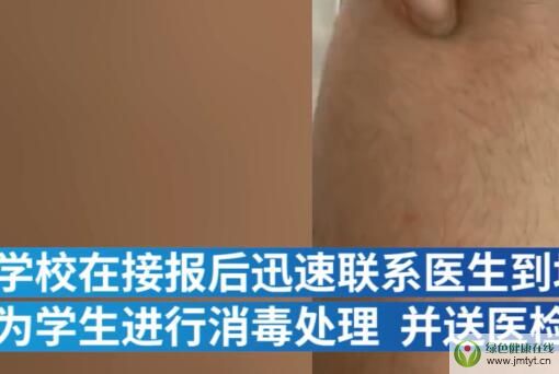 �ώ��ÈAҎ(gu��)��δ������I(y��)�W(xu��)������ô����