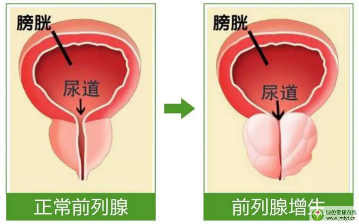 前列腺的作用.png 前列腺的作用.png